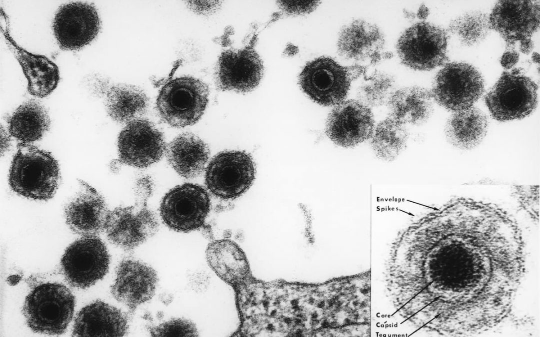 Human herpesvirus 6 (HHV-6) is the collective name for the two viruses